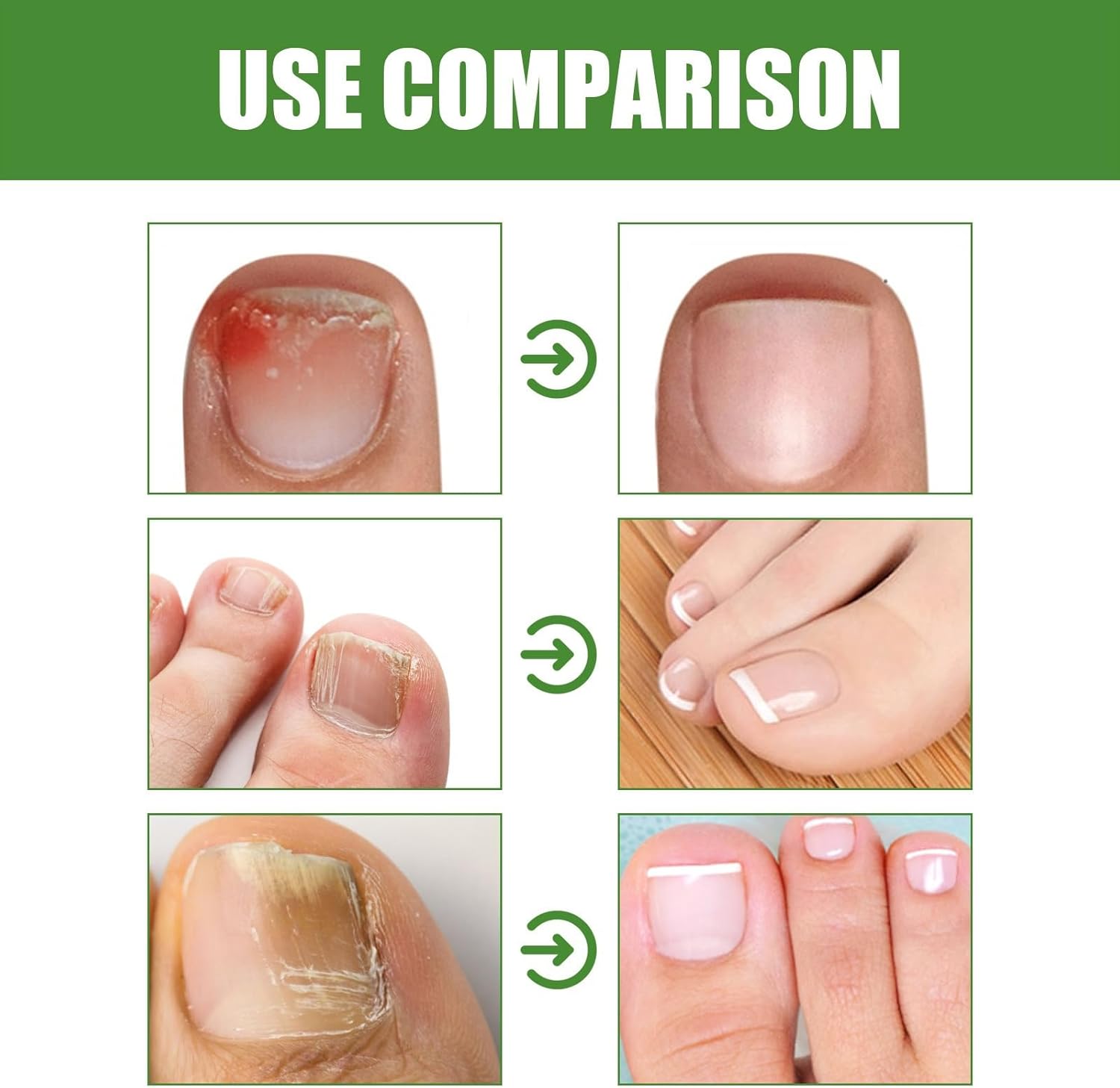 抗真菌スティック | DRMODE