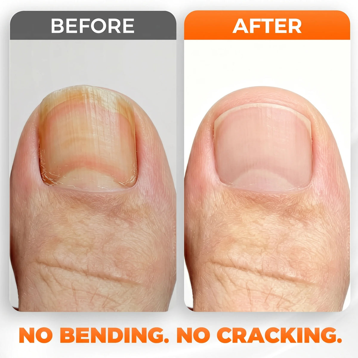 Before and after smooth trimming results using long stem toenail clippers on thick nails.