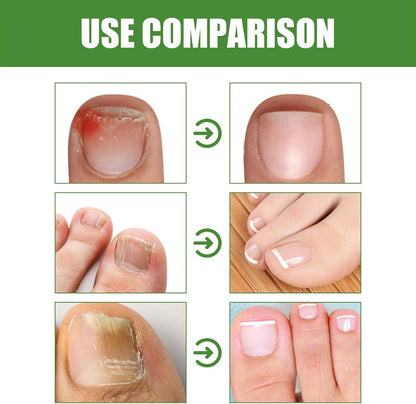 抗真菌スティック | DRMODE